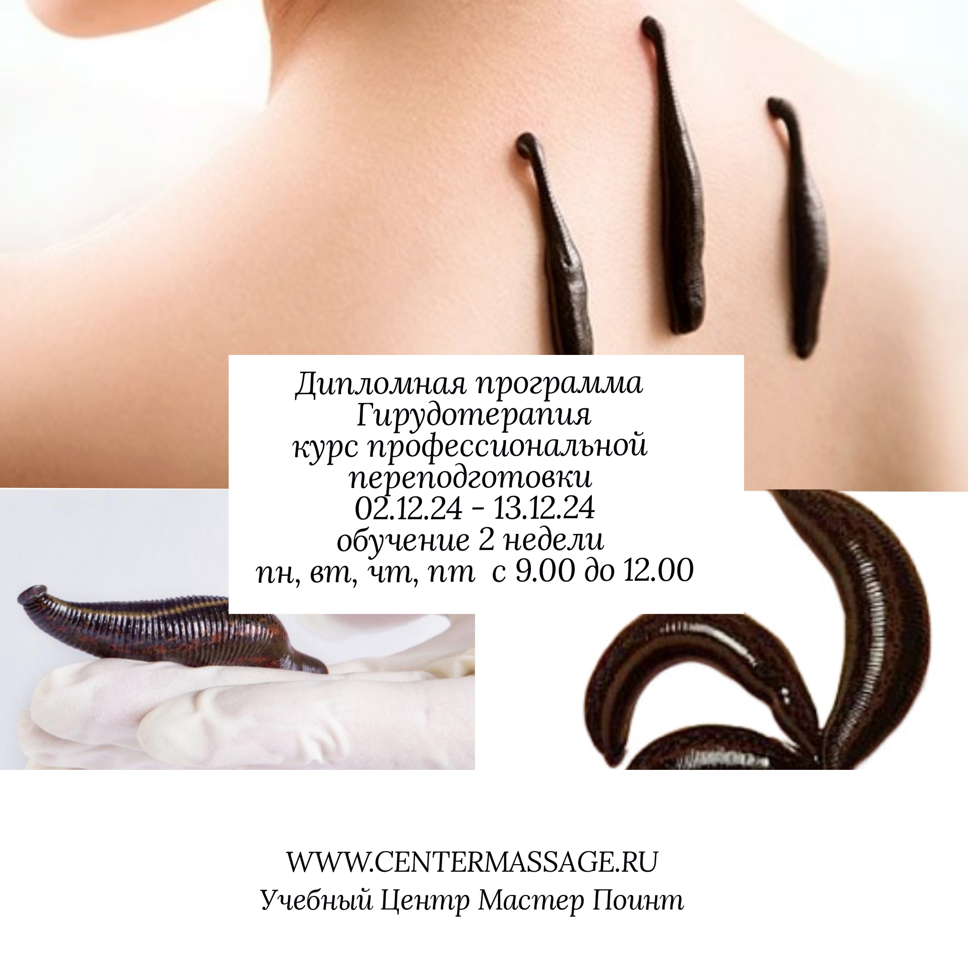обучение гирудотерапии